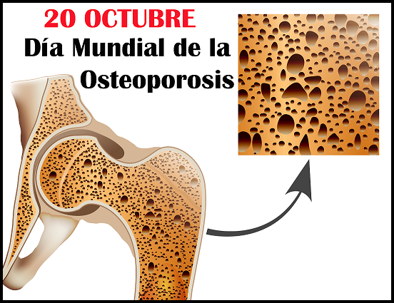 osteoporosisdia-mundial